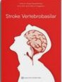 Image of Stroke Vertebrobasilar